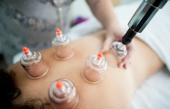 Acupuncture Practice with Expert